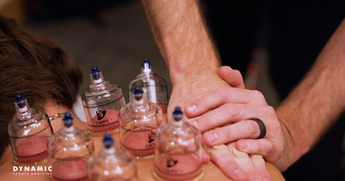 Cupping Therapy Near Me: What It Is, How It Works, and Where to Find It